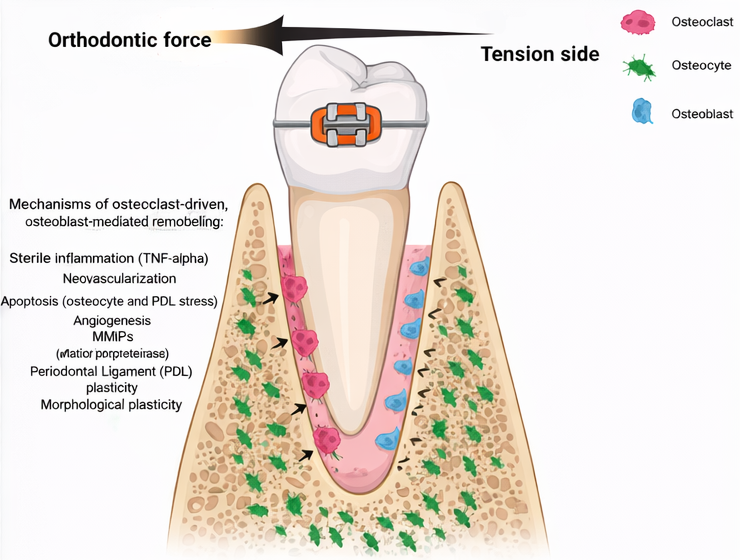 발산역 치과 &ldquo;이가 흔들려요!&rdquo; 교정 중 흔들림, 걱정할 필요가 있을까? 관련 이미지 1