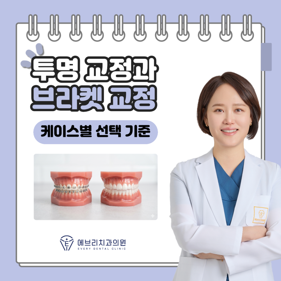 Clear Aligners vs. Bracket Orthodontics: How to Choose Based on Your Case, Explained by a Balsan-dong Dentist image 6