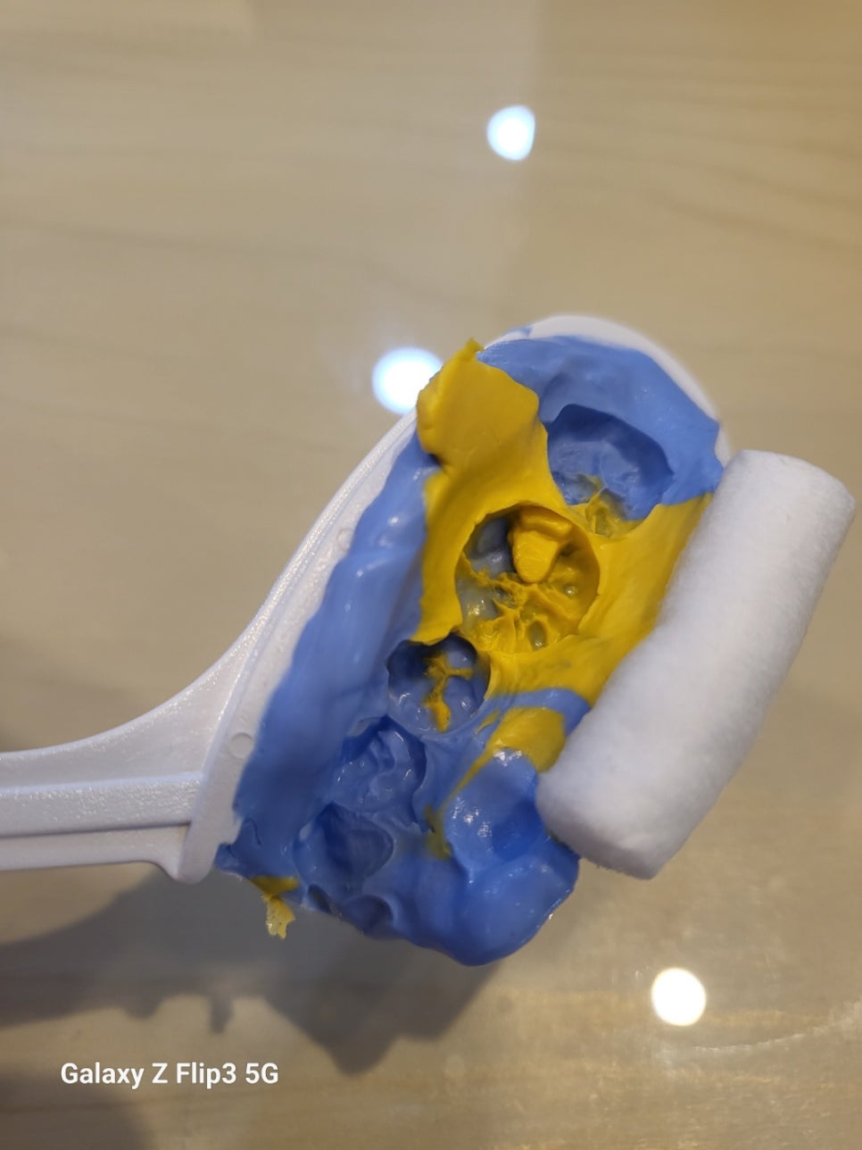Have You Found Dental Impressions Difficult? Every Dental Clinic Has Introduced an Intraoral Scanner. image 2