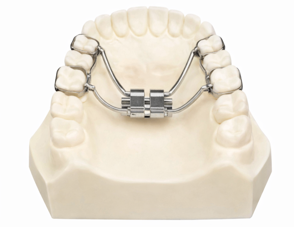 아이 입술&middot;입천장이 벌어졌다면? 마곡동 치과 의 구순구개열 구강 정보 관련 이미지 5