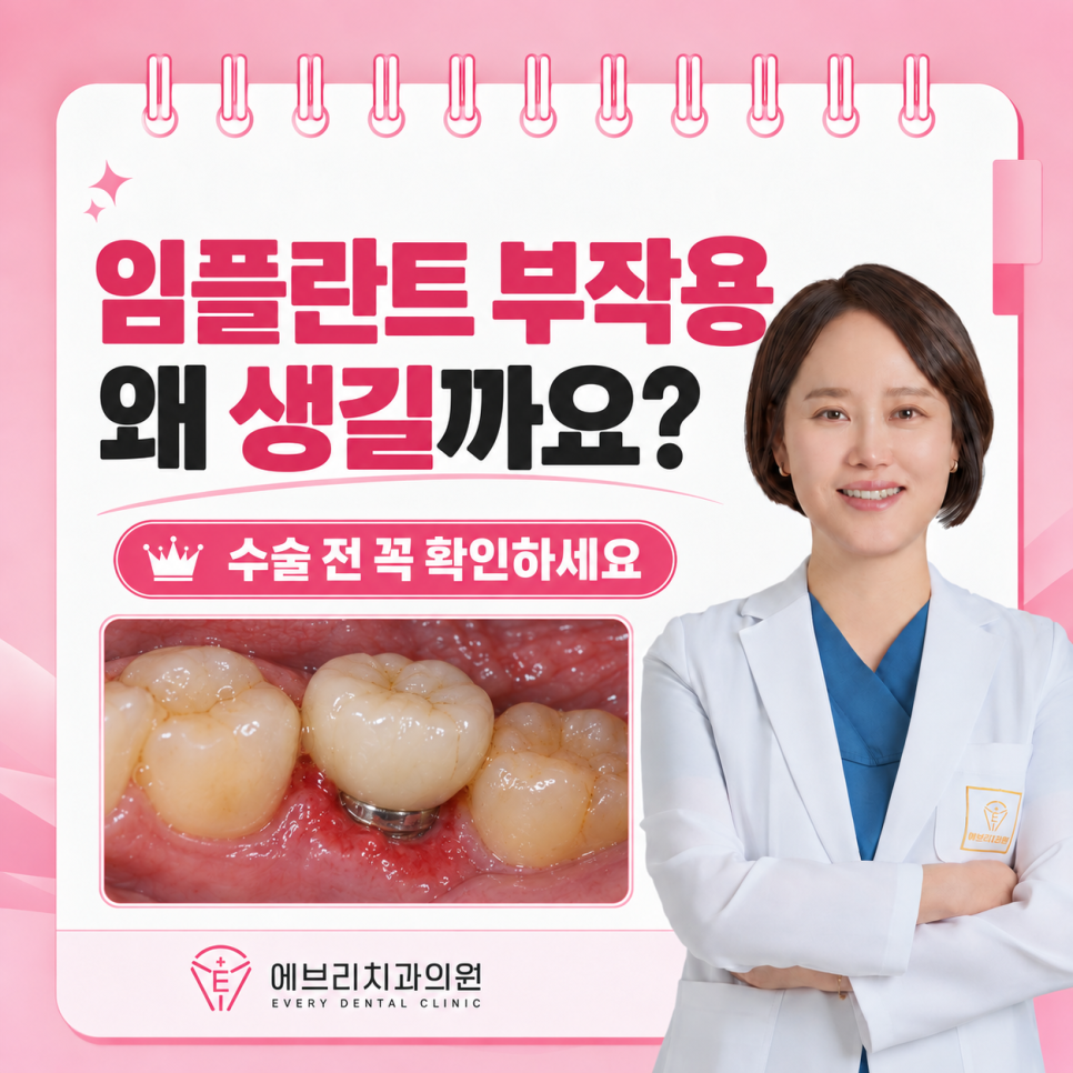 임플란트 부작용이 걱정된다면, 꼭 확인해야 할 것들 관련 이미지 8