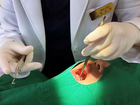 학생구강검진 여름시즌, 유치충치와 아이교정 꼭 확인하세요! 관련 이미지 8