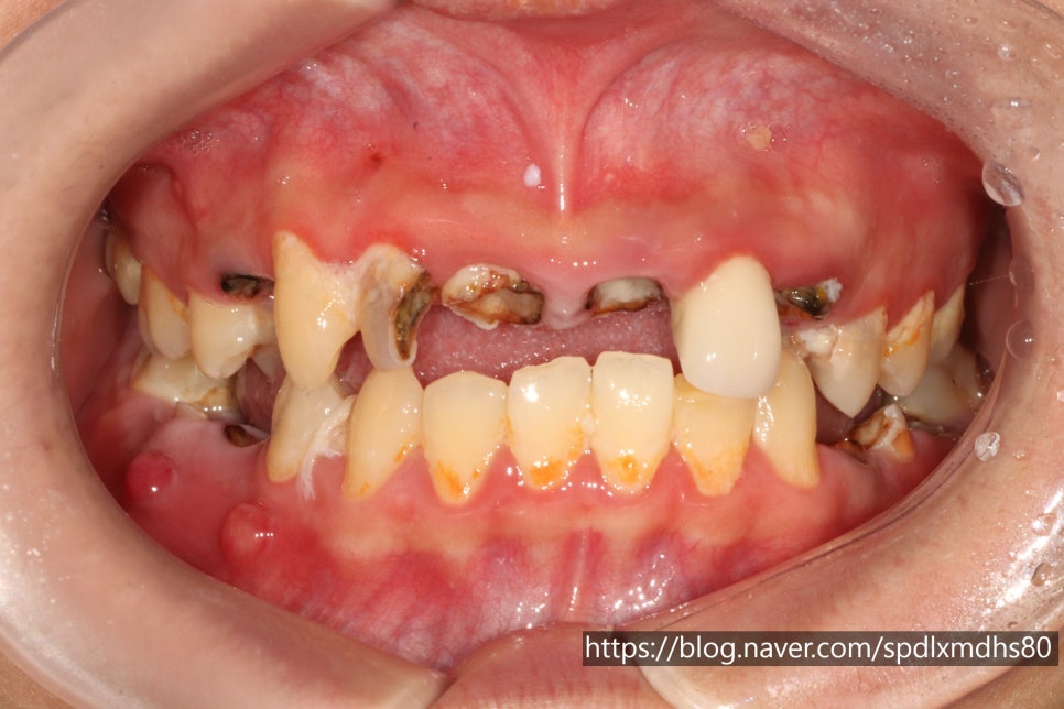 Naebalsan-dong Dental Clinic: Thoughtful Care for Those Worried About Pain image 1