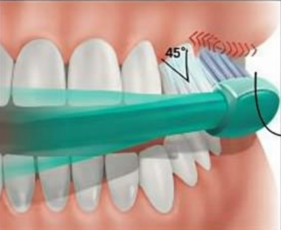 발산동 치과 전문의가 알려주는 치아 미백 완전 가이드 관련 이미지 5