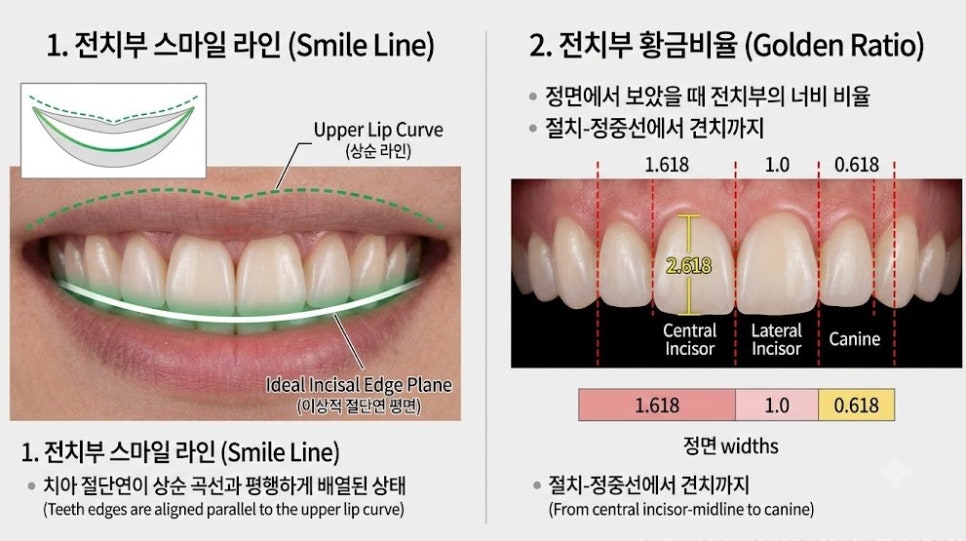 Naebalsan-dong Dental Laminates: Less Tooth Reduction, a More Beautiful Smile image 5
