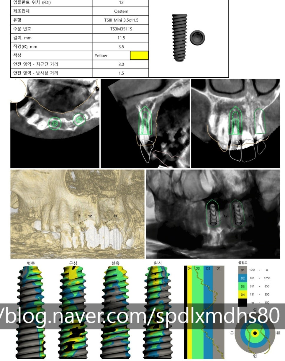 Naebalsan-dong Dental Clinic: Thoughtful Care for Those Worried About Pain image 6