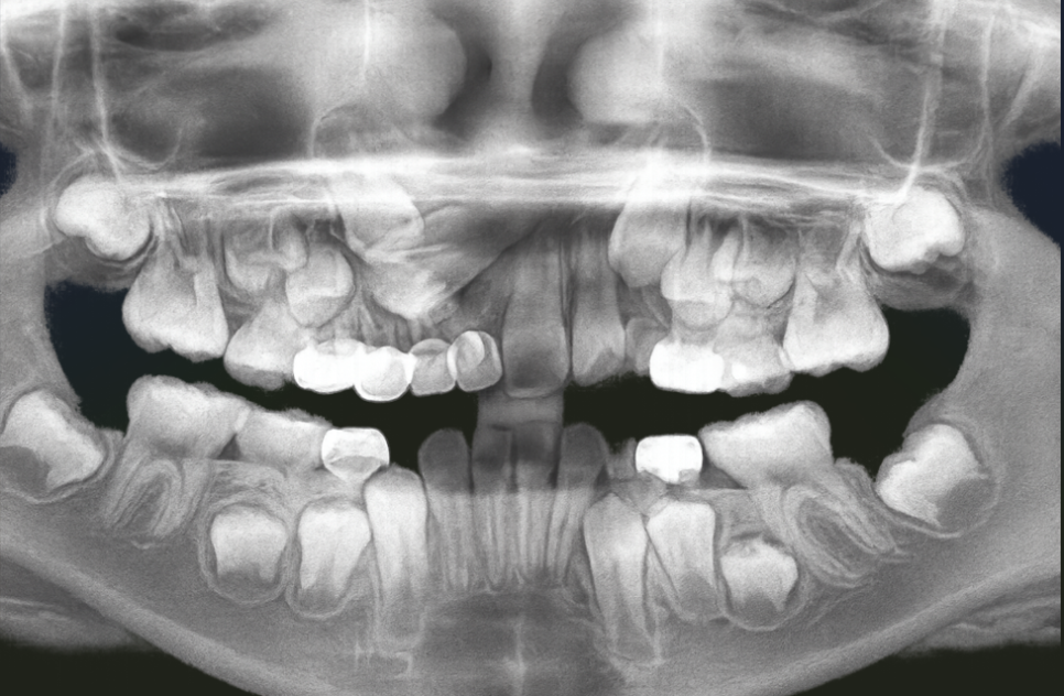 우장산역 치과 정기검진 & 연 1회 스케일링 왜 해야 될까? 관련 이미지 5
