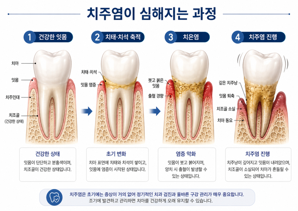 스케일링 1년에 한 번이면 충분할까요? 내발산동 치과에서 알려드립니다. 관련 이미지 2