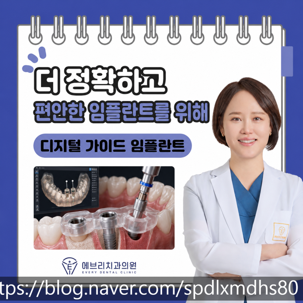 Gangseo-gu Dental Clinic: Can Implant Surgery Be Performed More Accurately and Comfortably? image 9