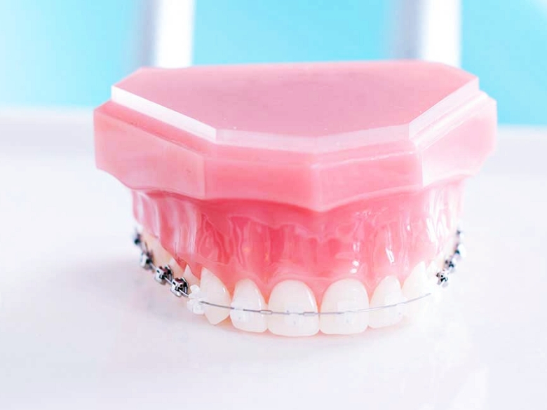 학생구강검진 여름시즌, 유치충치와 아이교정 꼭 확인하세요! 관련 이미지 5