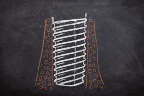 발치 후 임플란트 식립 시기 마곡동 치과 전문의 알려드립니다. 관련 이미지 2