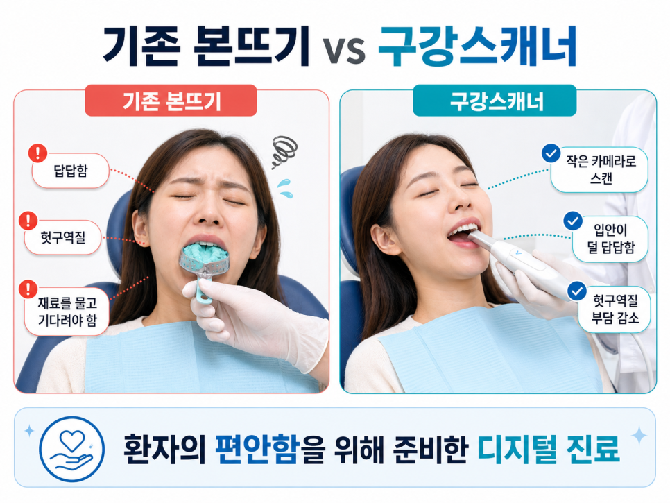 Have You Found Dental Impressions Difficult? Every Dental Clinic Has Introduced an Intraoral Scanner. image 1
