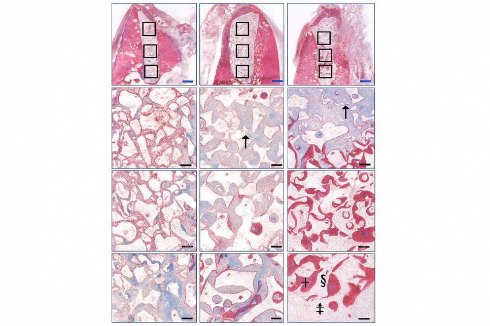 발산동 치과 리쥬란이라 불리는 PDRN 잇몸 치료 & 골이식 관련 이미지 6