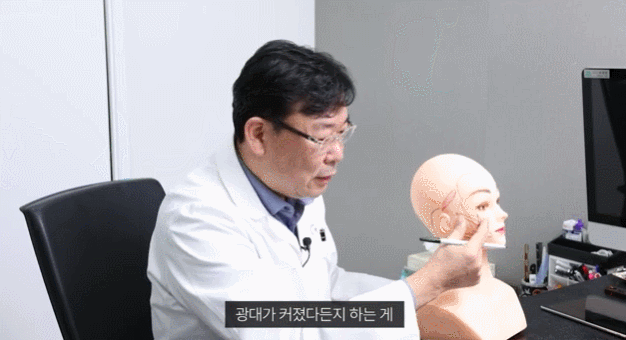 Mini Facelift Price? Check “This” Before Surgery and Decide. image 4