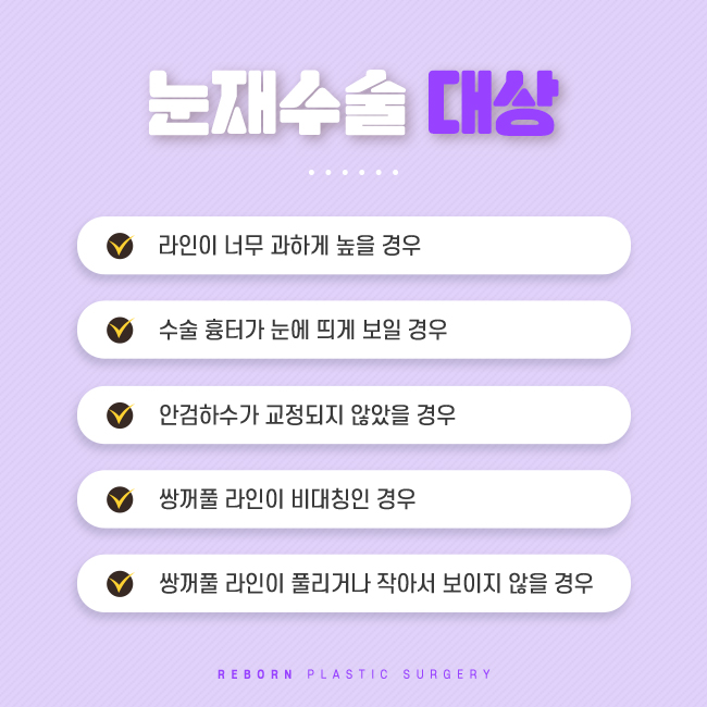 압구정눈재수술 있잖아, 마지막이야. 관련 이미지 3