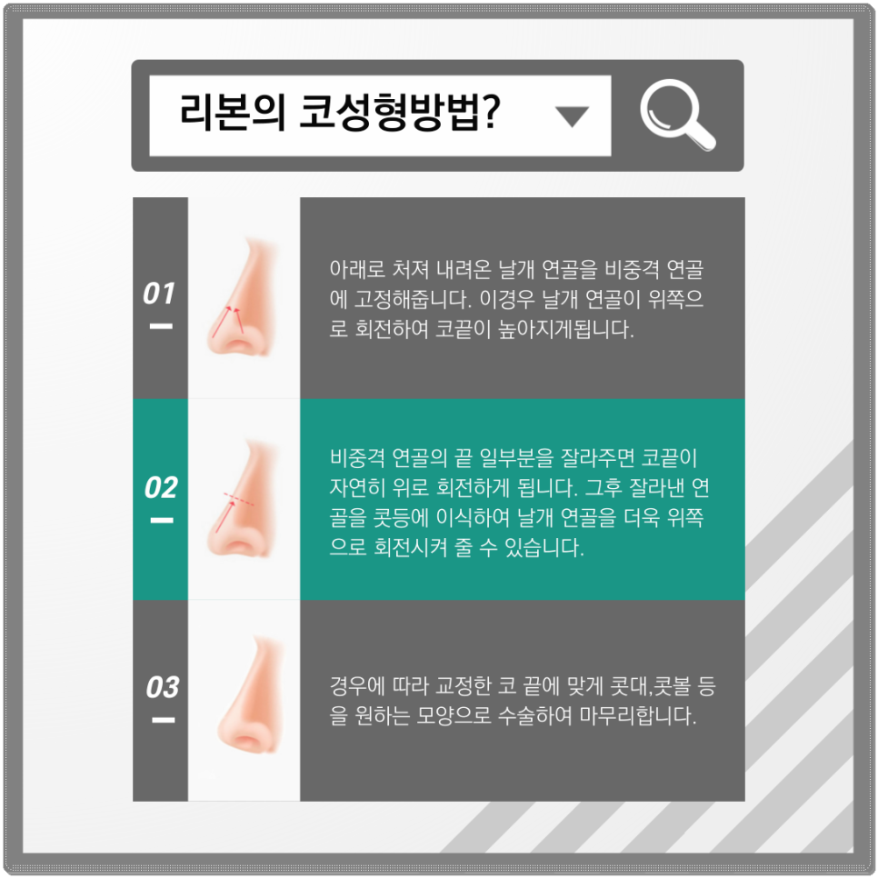 화살코 관상 고치고 싶으시다면&hellip;? 관련 이미지 3