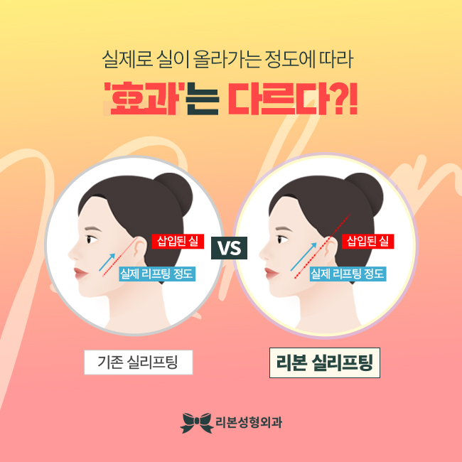 신사성형외과 슬림라인을 갖기 위해서 관련 이미지 3