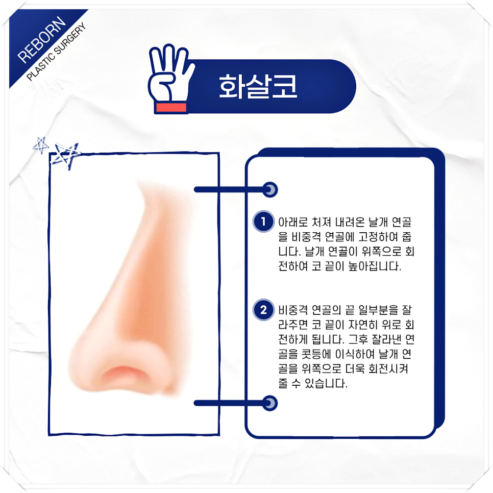 코 모양 종류 어떤 것도 상관없이 예쁜 코 만드세요! 관련 이미지 5