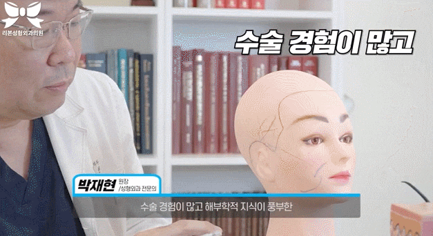 신논현 안면거상술? 쓰리스텝 관자거상에 대해 정리합니다. 관련 이미지 5