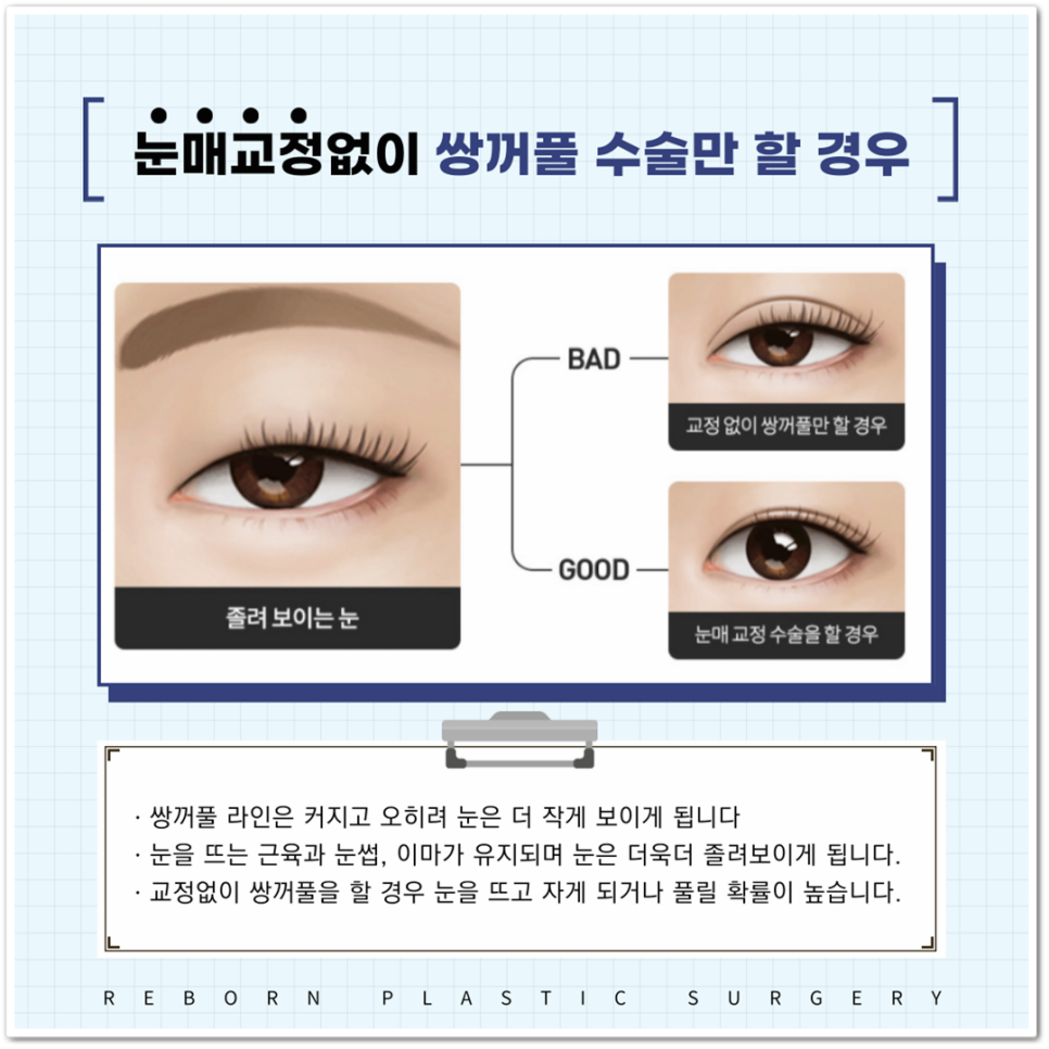 비절개눈매교정 절개와 차이점은 무엇일까? 주의사항 알아보자! 관련 이미지 4