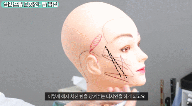 논현 실리프팅 잘하는 성형외과 관련 이미지 1