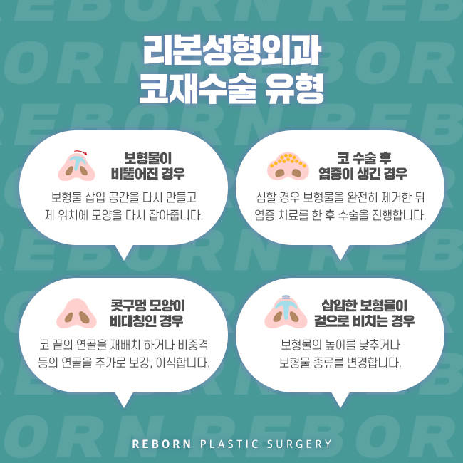 강남구코재수술 까다롭기에 더욱 신중해야 관련 이미지 4