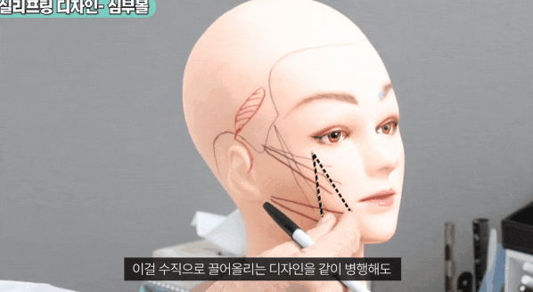 중안면부 리프팅 성형외과 전문의가 말하는 주의사항은? 관련 이미지 5
