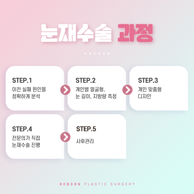 압구정역눈재수술 시작해 보기로 해 관련 이미지 2