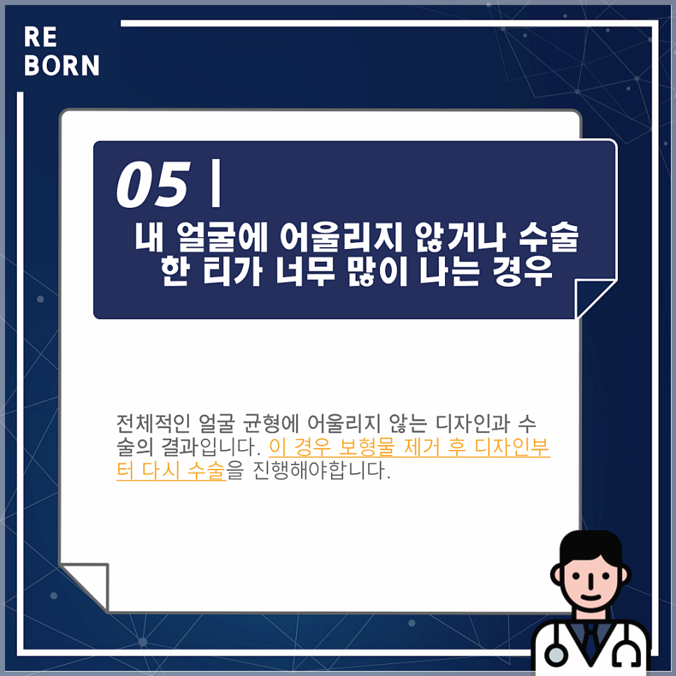 코재수술후기 좋은 리본에서 알려드리는 재수술방법! 관련 이미지 6