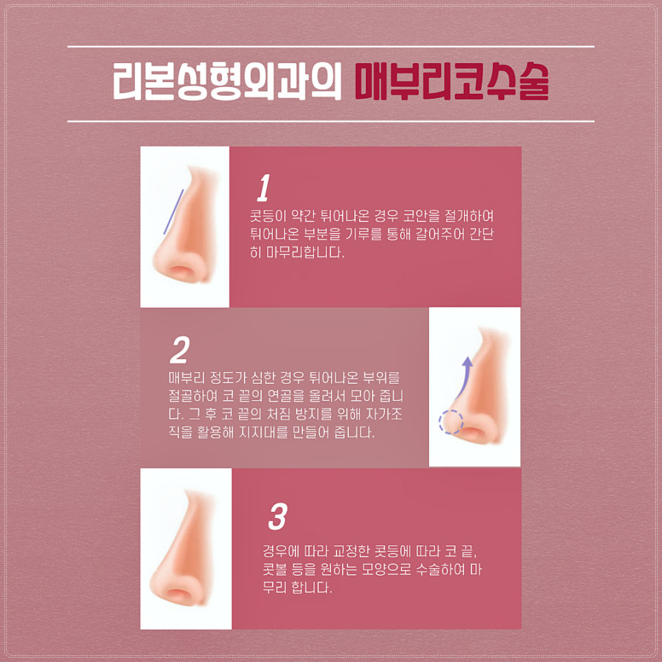 매부리코라도 걱정하지 마세요, 리본이 매력라인으로 바꿔드려요! 관련 이미지 3