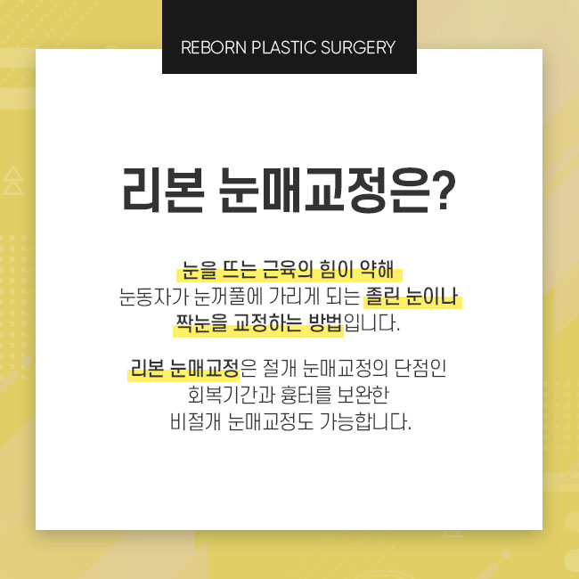 강남눈매교정 적절한 디자인과 방법으로 관련 이미지 2