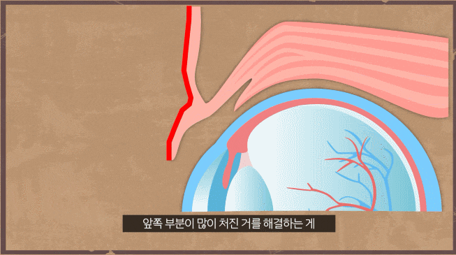 What Matters More Than Upper and Lower Blepharoplasty Cost! image 1