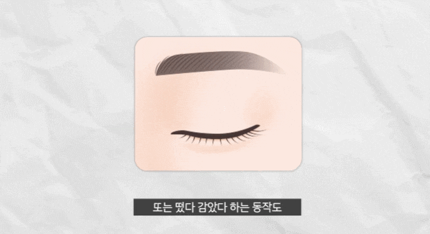 A Good Place for Eye Correction Near Sinnonhyeon image 5