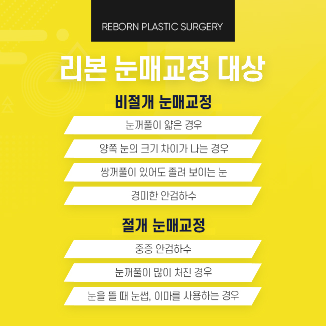 신사눈매교정 개인에 따라서 선택 중요 관련 이미지 3