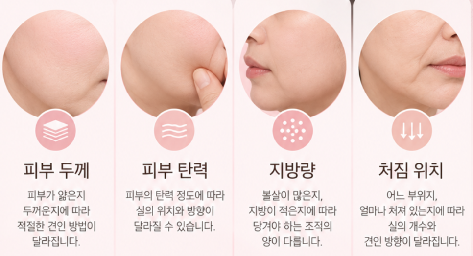 신사동 실리프팅 PDO·PLLA·PCL, 실의 종류에 따라 무엇이 다를까? 관련 이미지 4