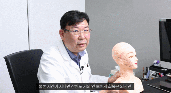 Read This Before Getting a Mini Facelift Lift image 5
