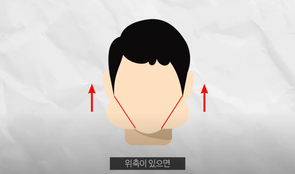 압구정 얼굴리프팅 적당한 때를 리본성형외과와 알아보자 관련 이미지 4