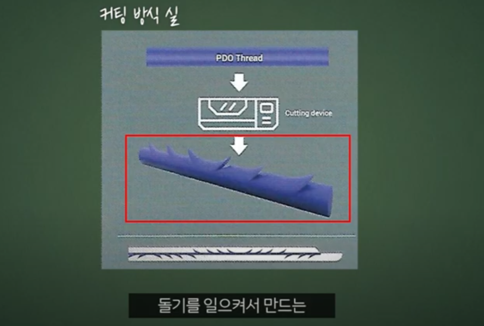 압구정 리프팅실종류 제작까지 직접 참여하는 관련 이미지 3