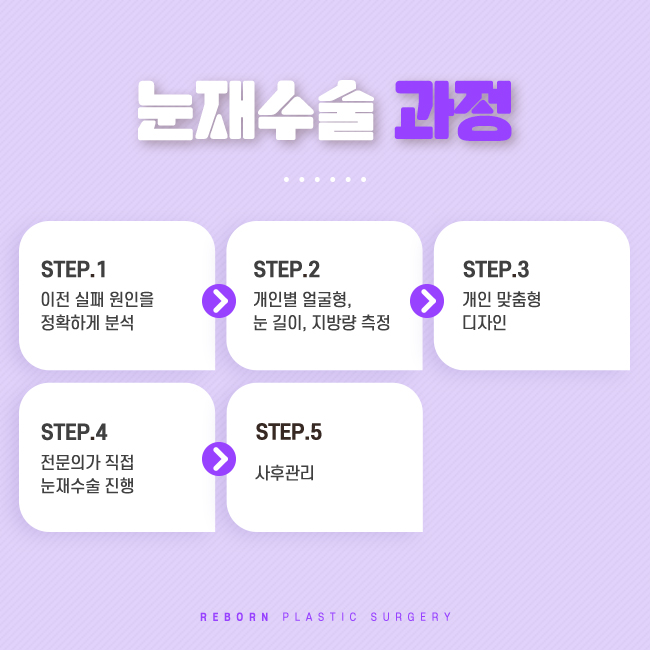 압구정눈재수술 있잖아, 마지막이야. 관련 이미지 2
