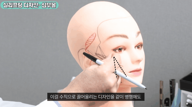 중안면부 실리프팅 가격 실 종류와 개수 무엇이 중요할까? 관련 이미지 3