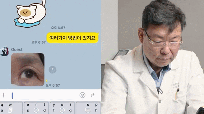 논현눈매교정: &lsquo;짝눈&rsquo; 한쪽만 교정해도 될까요? 관련 이미지 2