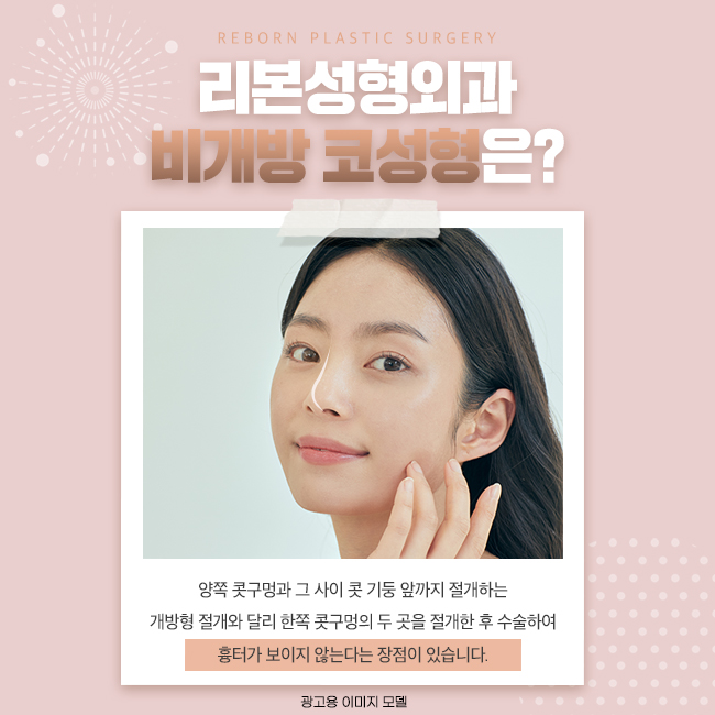 가로수길성형외과 코를 개방하지 않는 방법으로! 관련 이미지 2