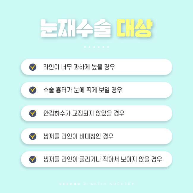 눈재수술잘하는곳 성공하기 위해선 관련 이미지 3