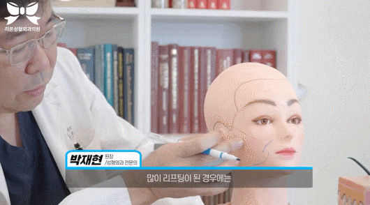 안면거상술 유명한 성형외과? 관련 이미지 6