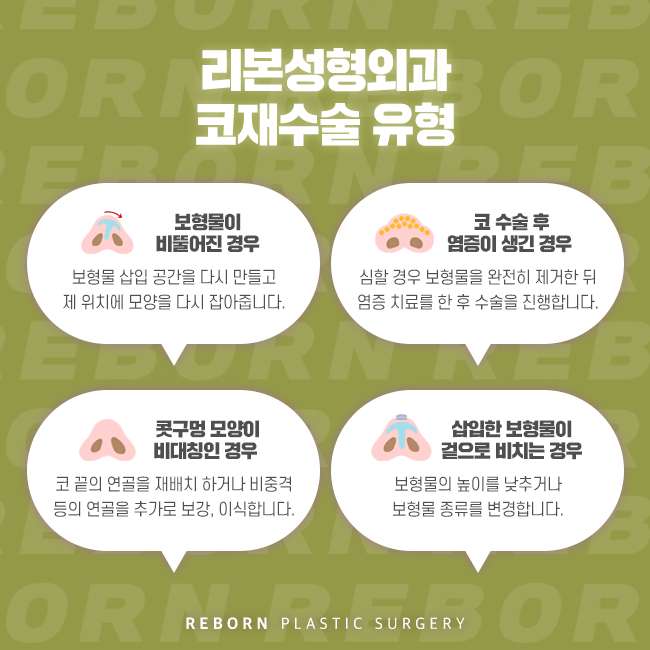 강남코재수술 안전과 만족도 모두 잡기 위해서는 관련 이미지 3