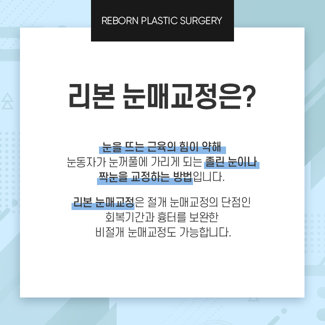 논현성형외과 눈매를 또렷하게 하는 방법 관련 이미지 2