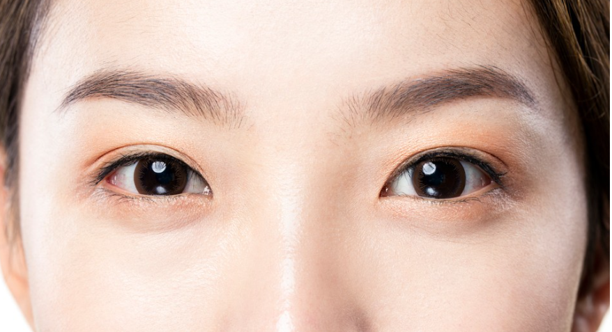 At Nonhyeon Station, a Plastic Surgery Clinic Explains the Differences Between Incisional and Non-Incisional Eye Correction. image 2