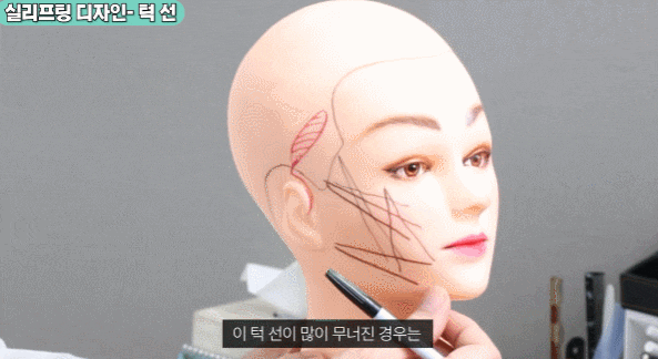 Read This Before Getting a Mini Facelift Lift image 3