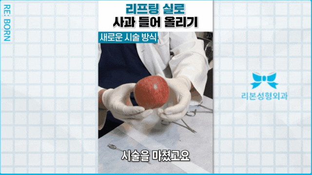 신사성형외과 실리프팅 잘하는곳 찾는 분들에게... 관련 이미지 3