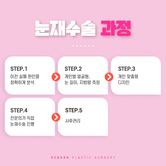 압구정눈재수술 다시 한번, 마지막으로 관련 이미지 2